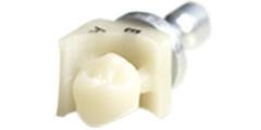 歯科用CAD/CAMシステムを用いたハイブリッドセラミックによる歯冠補綴